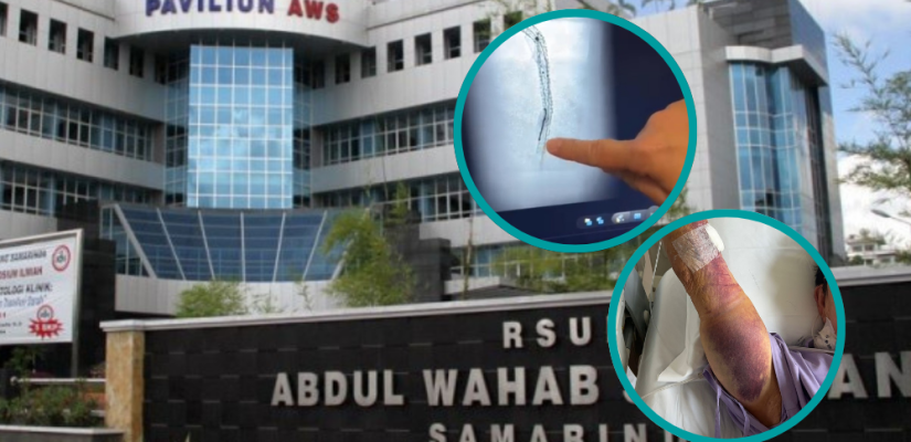 Kawat Tertinggal Pasca Operasi Jantung, Keluarga Somasi RSUD AWS Samarinda