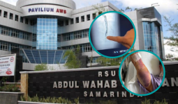 Kawat Tertinggal Pasca Operasi Jantung, Keluarga Somasi RSUD AWS Samarinda