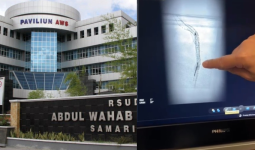 Terkait Kawat Tertinggal di Tubuh Pasien, RSUD AWS Minta Maaf dan Skorsing 6 Bulan Dokternya